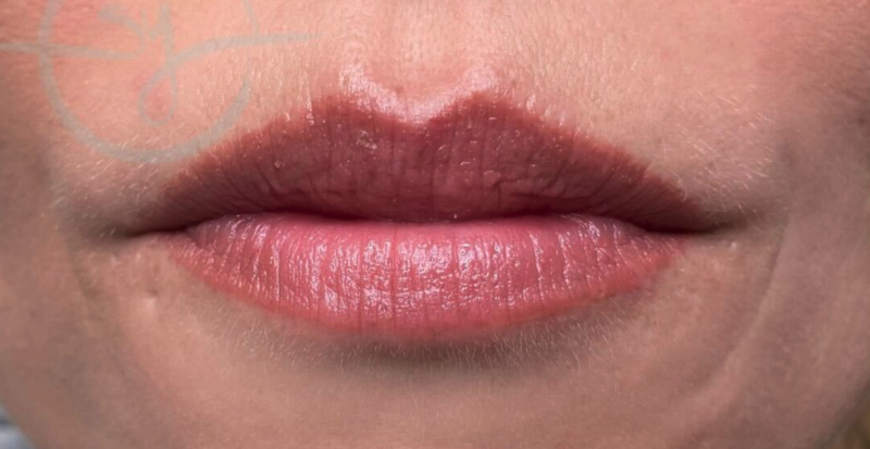 lippen pigmentierung 1